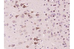 Immunohistochemistry (Paraffin-embedded Sections) (IHC (p)) image for anti-Fibronectin Type III and SPRY Domain Containing 1 (FSD1) (AA 421-496) antibody (ABIN1714771)