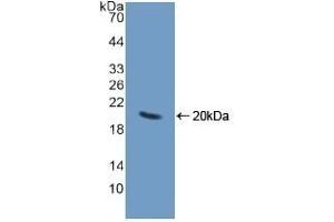 Detection of Recombinant CHGA, Human using Polyclonal Antibody to Chromogranin A (CHGA) (Chromogranin A 抗体  (AA 15-148))