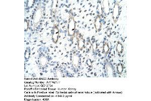 Rabbit Anti-BAG2 Antibody  Paraffin Embedded Tissue: Human Kidney Cellular Data: Epithelial cells of renal tubule Antibody Concentration: 4. (BAG2 抗体  (C-Term))