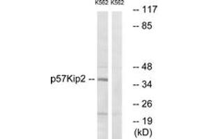 Western Blotting (WB) image for anti-Cyclin-Dependent Kinase Inhibitor 1C (p57, Kip2) (CDKN1C) (AA 267-316) antibody (ABIN2888853) (CDKN1C 抗体  (AA 267-316))