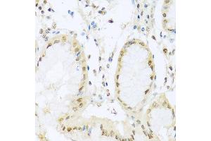 Immunohistochemistry of paraffin-embedded human stomach using PGR antibody at dilution of 1:100 (x40 lens). (Progesterone Receptor 抗体)