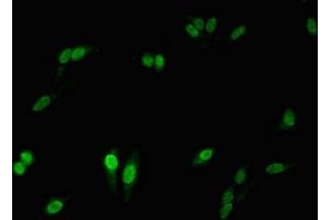 Immunofluorescence (IF) image for anti-Neutrophil Cytosolic Factor 2 (NCF2) (AA 178-526) antibody (ABIN7161498)