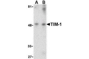 Western Blotting (WB) image for anti-Hepatitis A Virus Cellular Receptor 1 (HAVCR1) (Center) antibody (ABIN2476808) (HAVCR1 抗体  (Center))