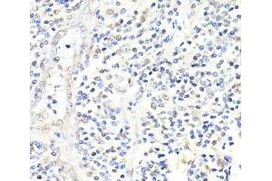 Immunohistochemistry of paraffin-embedded Human appendix using FKBP5 Polyclonal Antibody at dilution of 1:100 (40x lens). (FKBP5 抗体)