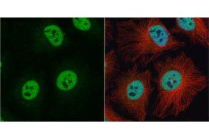 ICC/IF Image hnRNP C1/C2 antibody detects hnRNP C1/C2 protein at nucleus by immunofluorescent analysis. (HNRNPC 抗体)