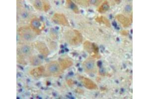 Used in DAB staining on fromalin fixed paraffin-embedded Liver tissue (FGF23 抗体  (AA 25-251))