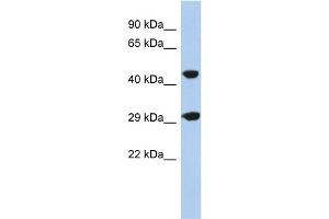 WB Suggested Anti-C22orf25 Antibody Titration: 0. (C22orf25 抗体  (N-Term))