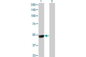 Western Blot analysis of UBR2 expression in transfected 293T cell line by UBR2 monoclonal antibody (M01A), clone 4G4. (UBR2 抗体  (AA 1-100))