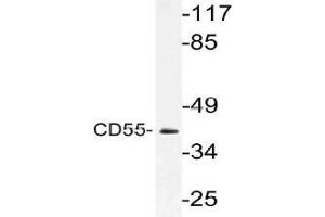 Western blot (WB) analysis of CD55 antibody in extracts from Jurkat cells. (CD55 抗体)