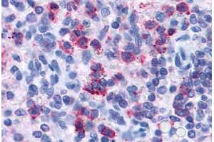 Anti-P2RY4 / P2Y4 antibody  ABIN1049218 IHC staining of human spleen. (P2RY4 抗体  (Cytoplasmic Domain))