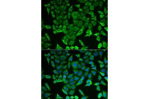 Immunofluorescence analysis of MCF-7 cells using RARS antibody (ABIN6127449, ABIN6146708, ABIN6146709 and ABIN6221913). (RARS 抗体  (AA 1-300))