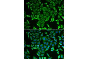 Immunofluorescence analysis of MCF-7 cells using RARS antibody (ABIN6127449, ABIN6146708, ABIN6146709 and ABIN6221913). (RARS 抗体  (AA 1-300))