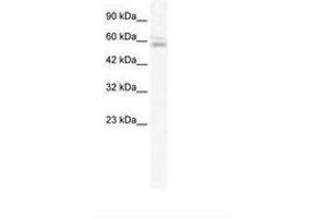 Image no. 1 for anti-Zinc Finger Protein 141 (ZNF141) (AA 143-192) antibody (ABIN202617) (ZNF141 抗体  (AA 143-192))