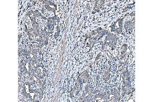 IHC analysis of HSPA6 using anti-HSPA6 antibody (ABIN7601944).