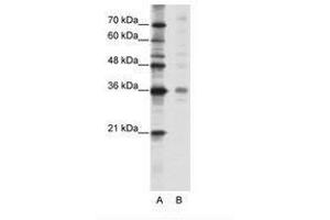 Image no. 1 for anti-Mediator Complex Subunit 27 (MED27) (C-Term) antibody (ABIN202216)