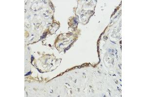 Immunohistochemistry of paraffin-embedded human placenta using H antibody (ABIN7267593) at dilution of 1:100 (40x lens). (HACE1 抗体  (AA 1-100))