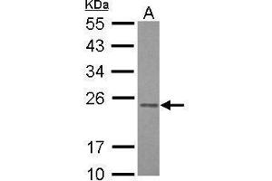 WB Image Sample (30 ug of whole cell lysate) A: HepG2 12% SDS PAGE antibody diluted at 1:1000 (RAB3B 抗体)