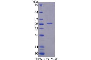 SDS-PAGE analysis of Human MCCC2 Protein. (MCCC2 蛋白)