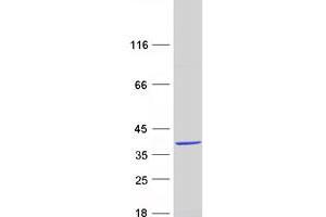 Validation with Western Blot