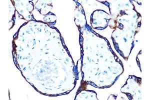 Immunohistochemistry of paraffin-embedded human placenta using Cytokeratin 7 (KRT7) (KRT7) Rabbit mAb  at dilution of 1:100 (40x lens). (Cytokeratin 7 抗体)