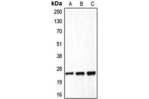 Western blot analysis of Claudin 5 expression in HeLa (A), mouse liver (B), rat lung (C) whole cell lysates. (Claudin 5 抗体  (C-Term))