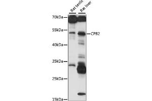 Western blot analysis of extracts of various cell lines, using CPB2 antibody (ABIN7266081) at 1:1000 dilution. (CPB2 抗体  (AA 310-410))