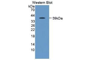 Western blot analysis of the recombinant protein. (CCL19 抗体  (AA 159-258))