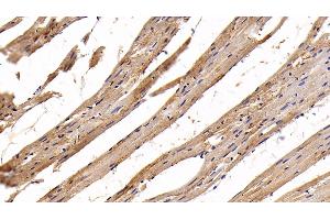 Detection of AST2 in Rat Cardiac Muscle Tissue using Polyclonal Antibody to Aspartate Aminotransferase 2 (AST2) (GOT2 抗体  (AA 30-430))