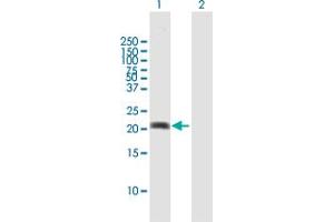Western Blot analysis of MPHOSPH6 expression in transfected 293T cell line by MPHOSPH6 MaxPab polyclonal antibody. (MPHOSPH6 抗体  (AA 1-160))