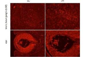 Immunohistochemistry of Rabbit anti-Six-3 antibody Immunohistochemistry of Rabbit anti-Six-3 antibody. (SIX3 抗体  (Internal Region))