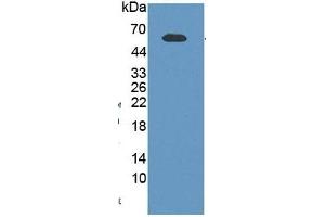 Western Blotting (WB) image for Nicotinamide phosphoribosyltransferase (NAMPT) ELISA Kit (ABIN6574184)