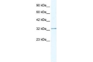 NUDT9 antibody used at 1. (NUDT9 抗体)