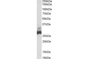 Image no. 2 for anti-Succinate Dehydrogenase Complex, Subunit B, Iron Sulfur (Ip) (SDHB) (C-Term) antibody (ABIN185447)