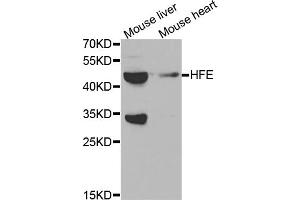 Western blot analysis of extracts of various cell lines, using HFE antibody. (HFE 抗体)