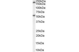 Western Blotting (WB) image for anti-Serotonin Receptor 3A (HTR3A) (Internal Region) antibody (ABIN2466257) (Serotonin Receptor 3A 抗体  (Internal Region))