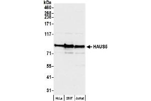 Western Blotting (WB) image for anti-HAUS Augmin-Like Complex, Subunit 5 (HAUS5) (AA 75-125) antibody (ABIN7452821)