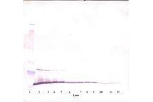 Image no. 2 for anti-Melanoma Inhibitory Activity (MIA) antibody (ABIN464851) (MIA 抗体)