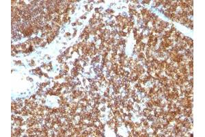 Image no. 1 for anti-CD45RB (CD45RB) antibody (ABIN6170687) (CD45RB 抗体)