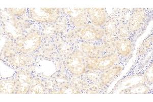 Detection of ANG in Human Kidney Tissue using Polyclonal Antibody to Angiogenin (ANG) (ANG 抗体  (AA 25-147))