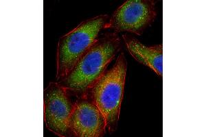 Fluorescent confocal ige of A549 cell stained with PK14 Antibody (Center /) (ABIN656420 and ABIN2845711).