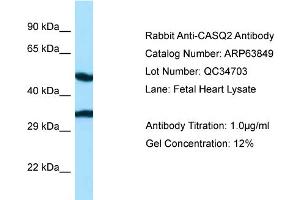 Western Blotting (WB) image for anti-Calsequestrin 2 (CASQ2) (N-Term) antibody (ABIN970293) (CASQ2 抗体  (N-Term))