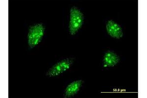 Immunofluorescence of monoclonal antibody to MEOX2 on HeLa cell. (MEOX2 抗体  (AA 1-303))