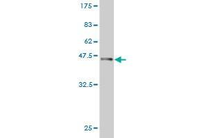 Western Blot detection against Immunogen (36. (PKNOX1 抗体  (AA 2-100))