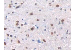 DAB staining on IHC-P; Samples: Rat Spinal cord Tissue (Renin 抗体  (AA 275-389))
