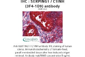 Image no. 2 for anti-Serpin Peptidase Inhibitor, Clade G (C1 Inhibitor), Member 1 (SERPING1) (AA 1-501), (full length) antibody (ABIN1723814) (SERPING1 抗体  (full length))