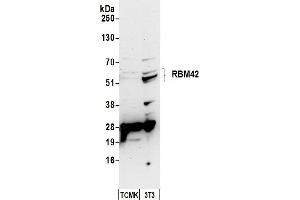 anti-RNA Binding Motif Protein 42 (RBM42) (AA 430-480) antibody