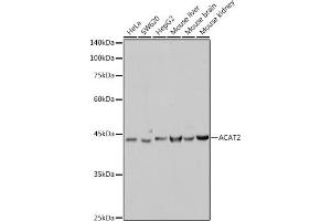 Western blot analysis of extracts of various cell lines, using  antibody (ABIN7265364) at 1:1000 dilution. (ACAT2 抗体)