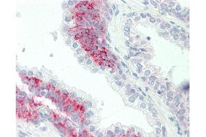 Anti-PAK4 antibody IHC staining of human prostate. (PAK4 抗体  (AA 187-216))