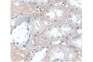 DAB staining on IHC-P Samples:Human Kidney Tissue) (APOA1 抗体  (AA 122-267))