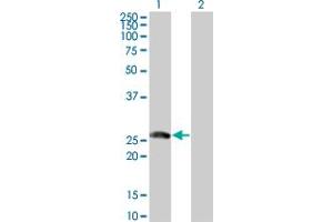Western Blot analysis of BTG4 expression in transfected 293T cell line by BTG4 monoclonal antibody (M07), clone 1A6. (BTG4 抗体  (AA 1-206))